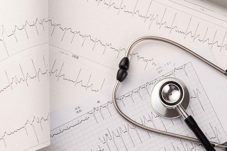 循環器内科イメージ画像