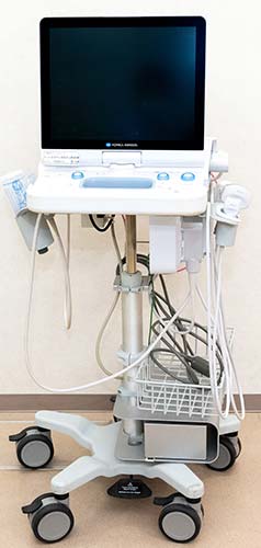 エコー検査機器