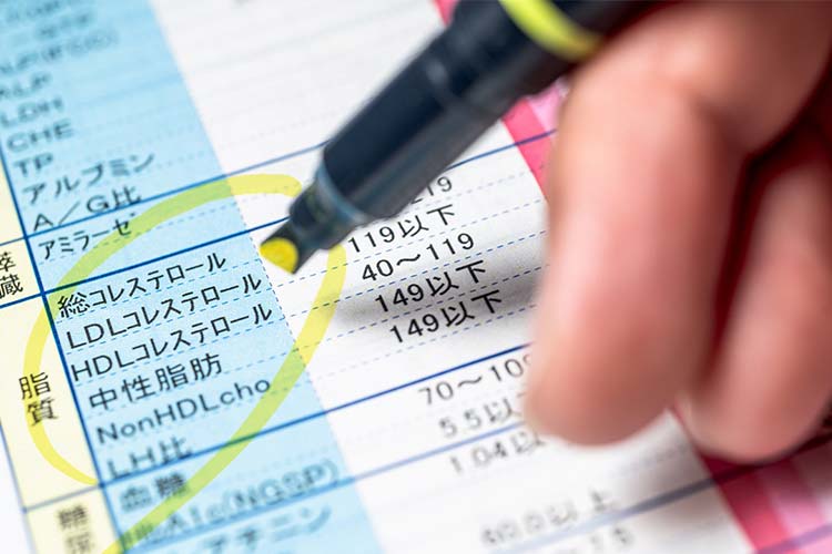 脂質異常症イメージ画像