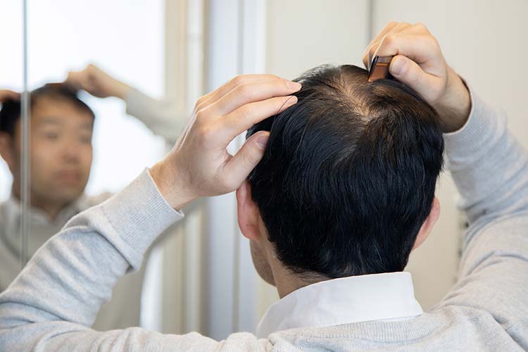 AGAイメージ画像